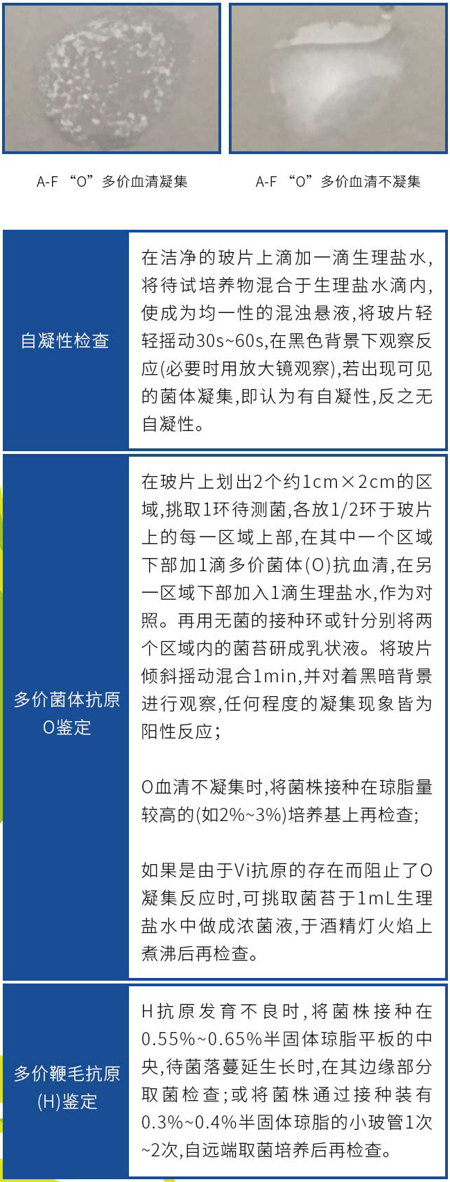 血清试验 血清试验